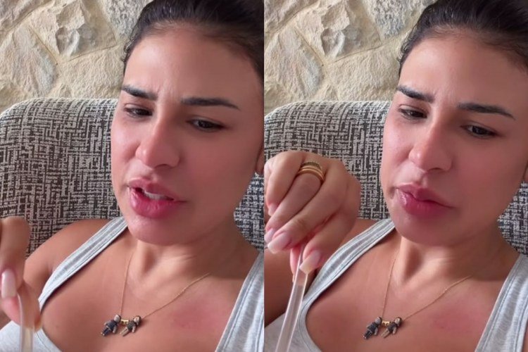 Simone Mendes revela retirada de 4 kg de pele em cirurgia nas coxas​‌​